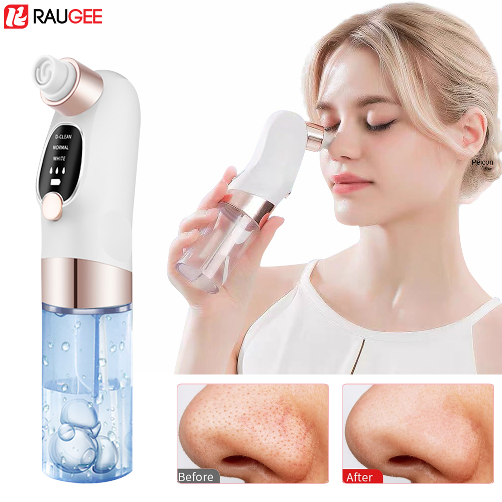 مزيل الرؤوس السوداء الكهربائية - مراجعة Nasal Aspirator وسعره