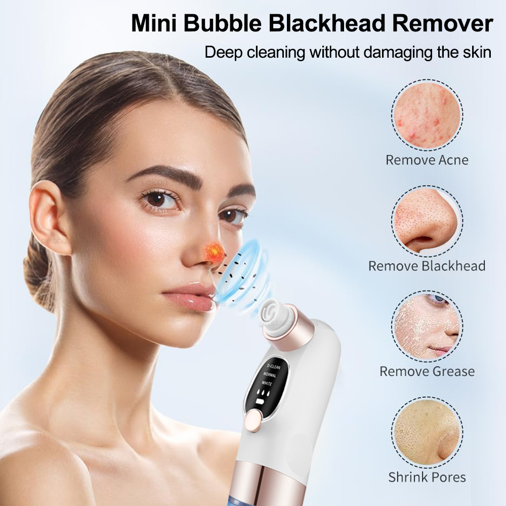 مزيل الرؤوس السوداء الكهربائية - مراجعة Nasal Aspirator وسعره